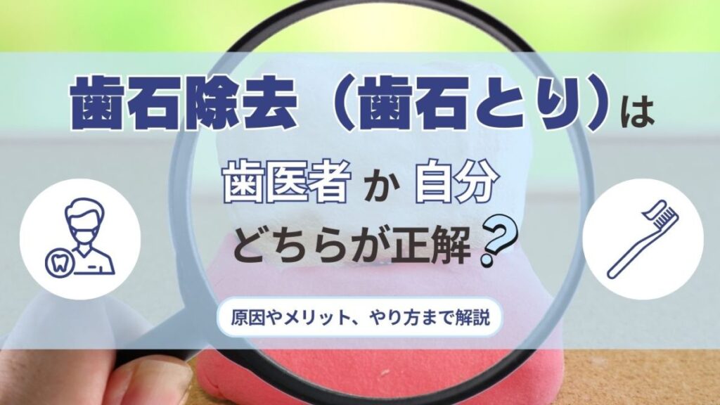サムネイル_歯石除去（歯石とり）は歯医者か自分で、どちらが正解？原因やメリット、やり方まで解説