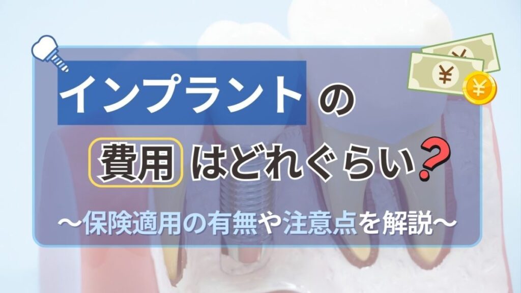 サムネイル_インプラントの費用はどれぐらい？保険適用の有無や注意点を解説