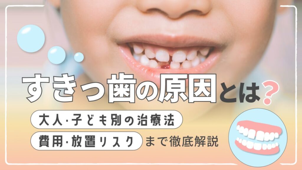 すきっ歯の原因とは？大人・子ども別の治療法や費用、放置リスクまで徹底解説