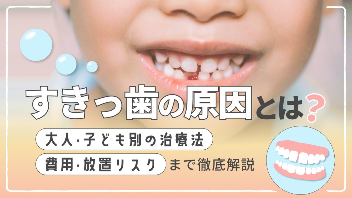 すきっ歯の原因とは？大人・子ども別の治療法や費用、放置リスクまで徹底解説