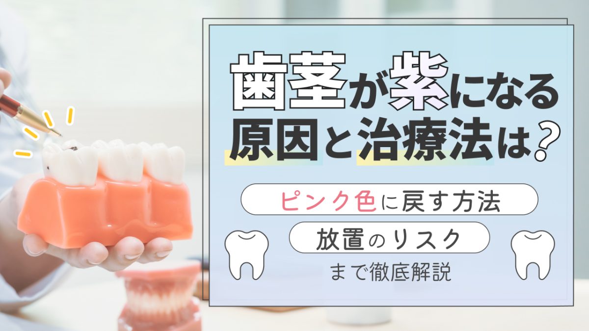歯茎が紫になる原因と治療法は？ピンク色に戻す方法や放置のリスクまで徹底解説