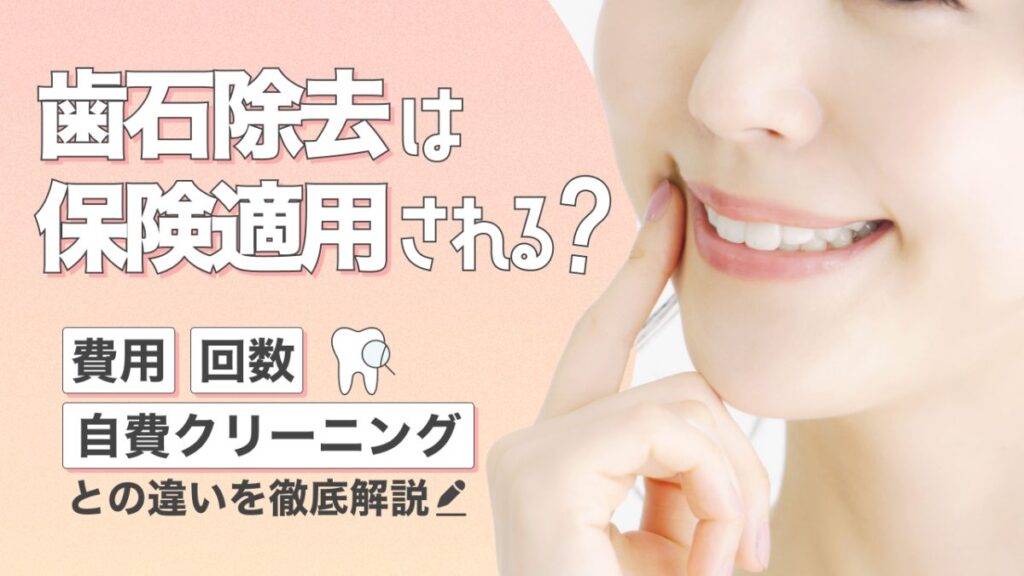 歯石除去は保険適用される？費用・回数・自費クリーニングとの違いを徹底解説