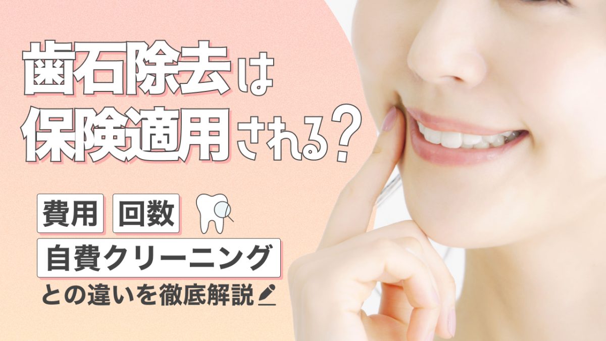 歯石除去は保険適用される？費用・回数・自費クリーニングとの違いを徹底解説