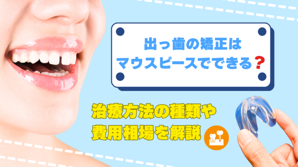 出っ歯の矯正はマウスピースでできる？治療方法の種類や費用相場を解説