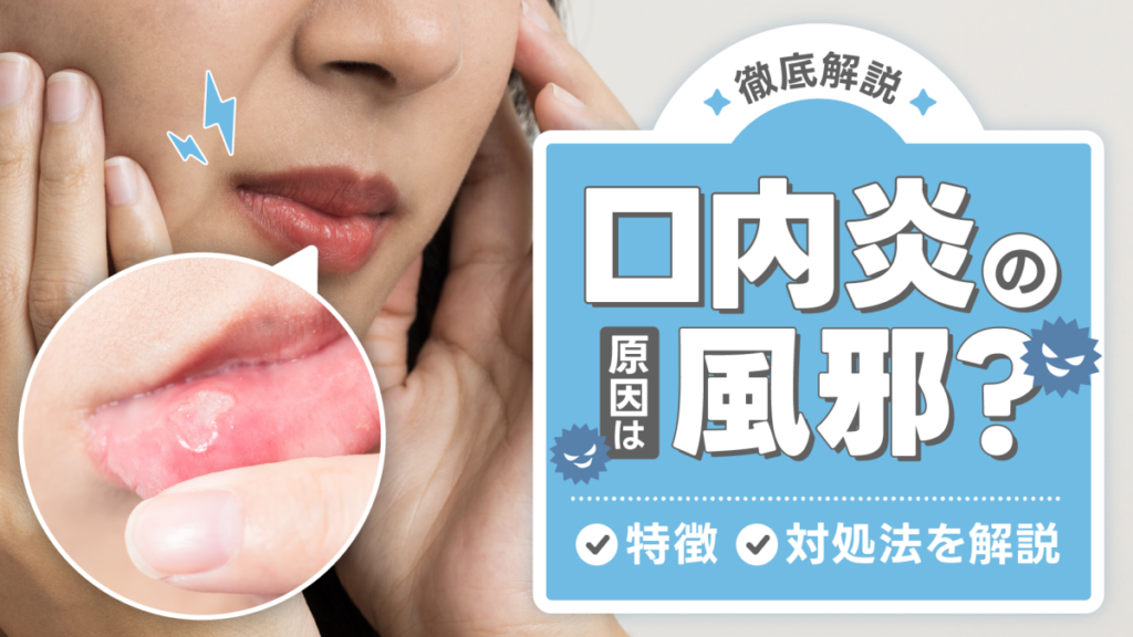 口内炎の原因は風邪？特徴や対処法を解説