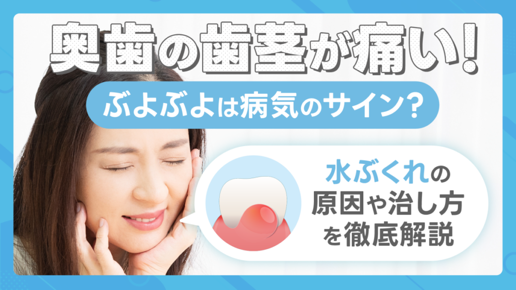 奥歯の歯茎が痛い・ぶよぶよは病気のサイン？白い・水ぶくれの原因や治し方を徹底解説