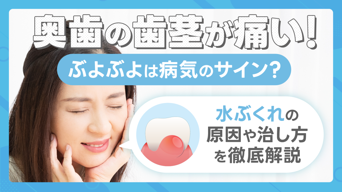奥歯の歯茎が痛い・ぶよぶよは病気のサイン？白い・水ぶくれの原因や治し方を徹底解説
