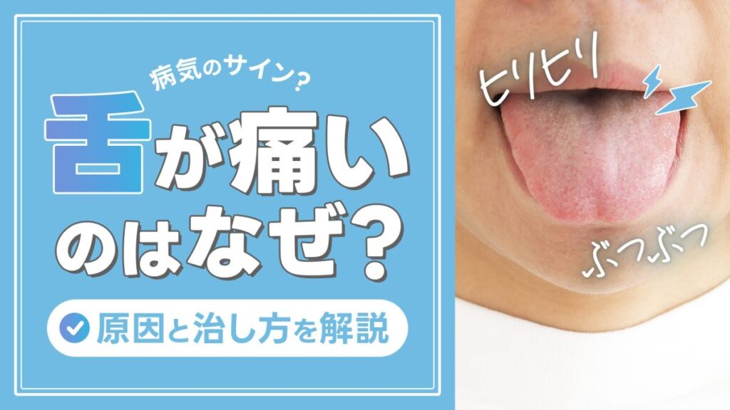 舌が痛いのはなぜ？ヒリヒリする・ぶつぶつの原因と治し方を解説