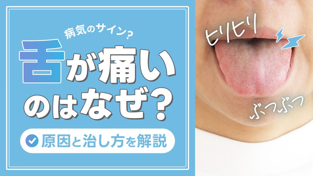 舌が痛いのはなぜ？ヒリヒリする・ぶつぶつの原因と治し方を解説