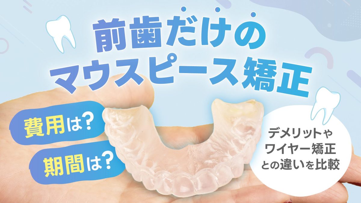 前歯だけのマウスピース矯正｜費用・期間・デメリット、ワイヤー矯正との違いも比較