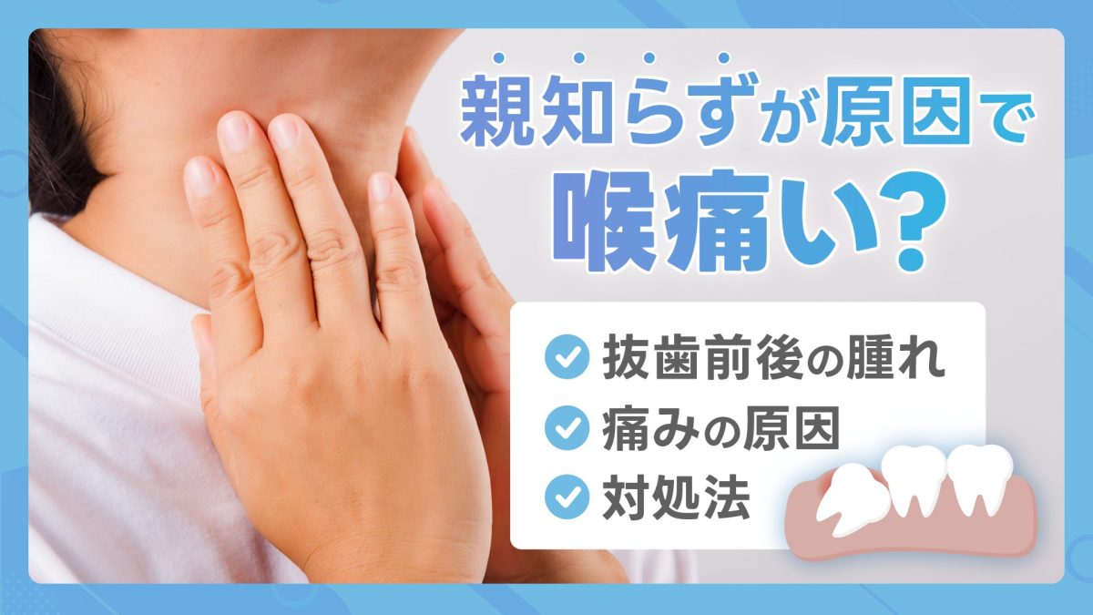 親知らずが原因で喉が痛い？抜歯前後の腫れや痛みの原因・対処法を解説