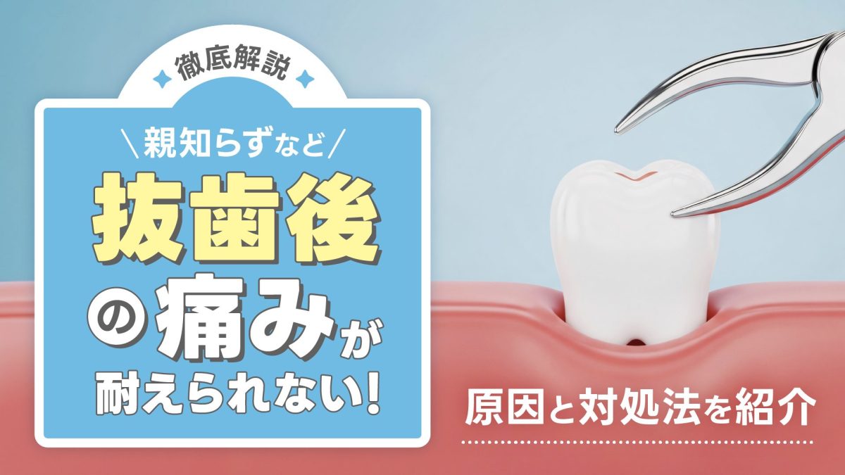 親知らずなど抜歯後の痛みが続くのはなぜ？ピークの時期や原因、対処法を解説