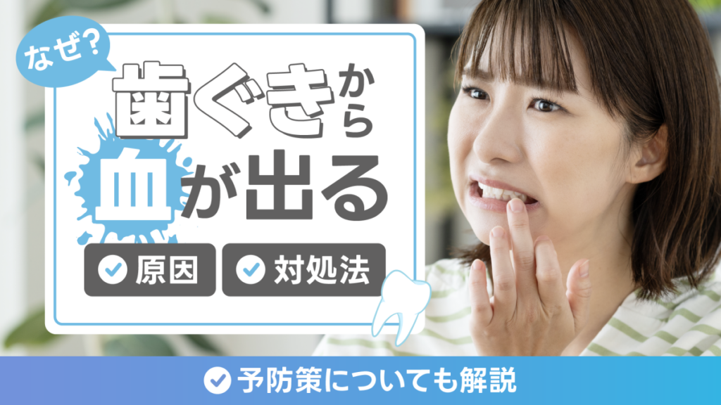 歯ぐきから血が出るのはなぜ？原因や対処法、予防策を解説